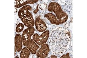 Immunohistochemical staining of human kidney with APIP polyclonal antibody  shows cytoplasmic and nuclear positivity in tubular cells. (APIP antibody)