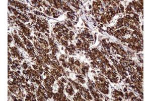 Image no. 13 for anti-B and T Lymphocyte Associated (BTLA) antibody (ABIN1496983)