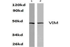 Image no. 1 for anti-Vimentin (VIM) antibody (ABIN271977) (Vimentin antibody)