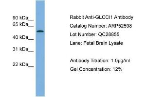 WB Suggested Anti-GLCCI1  Antibody Titration: 0. (GLCCI1 antibody  (Middle Region))