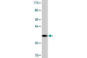 Western Blot detection against Immunogen (36. (COG3 antibody  (AA 25-124))