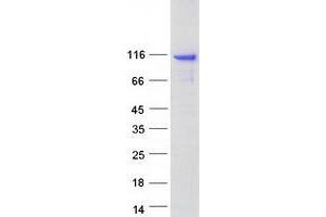 Validation with Western Blot