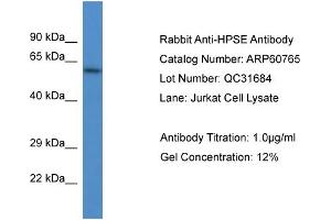 Western Blotting (WB) image for anti-Heparanase (HPSE) (N-Term) antibody (ABIN786265) (HPSE antibody  (N-Term))