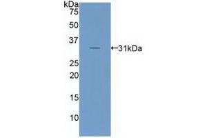Detection of Recombinant LRP6, Human using Polyclonal Antibody to Low Density Lipoprotein Receptor Related Protein 6 (LRP6) (LRP6 antibody  (AA 981-1213))