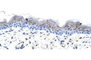 Immunohistochemical staining (Formalin-fixed paraffin-embedded sections) of human skin with IRX3 polyclonal antibody  at 4-8 ug/mL working concentration. (IRX3 antibody  (C-Term))