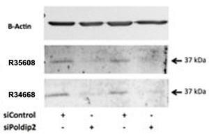 Western blot testing of rat VSMC lysate with POLDIP2 antibody at 0. (POLDIP2 antibody)