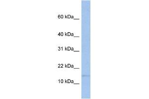 WB Suggested Anti-TRAPPC2 Antibody Titration:  0. (TRAPPC2 antibody  (Middle Region))