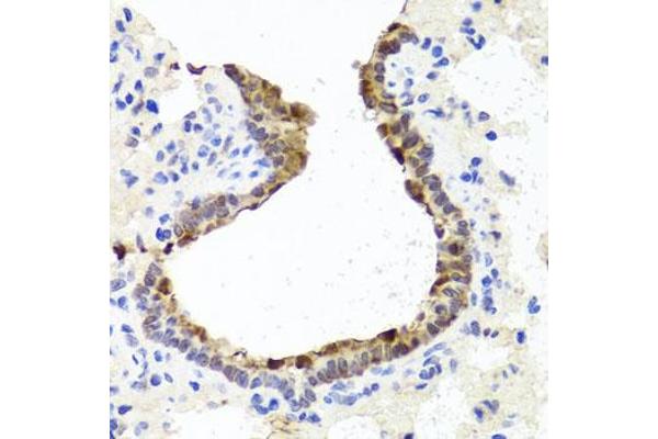 TOPBP1 antibody  (AA 1-100)