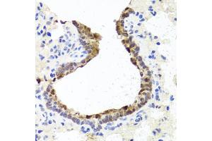 Immunohistochemistry of paraffin-embedded rat lung using TOPBP1 antibody (ABIN6134114, ABIN6149397, ABIN6149400 and ABIN6216254) at dilution of 1:100 (40x lens). (TOPBP1 antibody  (AA 1-100))