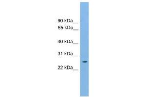 WB Suggested Anti-Hoxb9 Antibody Titration:  0. (HOXB9 antibody  (N-Term))