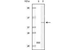 Western Blotting (WB) image for anti-Calcium and Integrin-Binding Protein 1 (CIB1) (truncated) antibody (ABIN2464036)