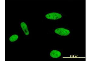 Immunofluorescence of monoclonal antibody to MLLT1 on HeLa cell. (MLLT1 antibody  (AA 472-559))