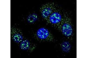 Confocal immunofluorescent analysis of MGMT antibody with MCF-7 cells followed by Alexa Fluor 488-conjugated goat anti-rabbit lgG (green). (MGMT antibody  (AA 1-30))