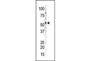 Western blot of CAMK2G / CAMKG Antibody to detect CAMK2 gamma in Mouse heart tissue lysate. (CAMKII gamma antibody  (C-Term))
