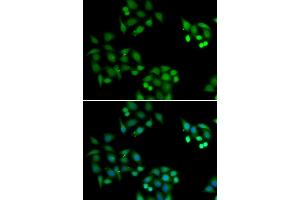 Immunofluorescence analysis of HeLa cells using NSFL1C antibody (ABIN6131003, ABIN6144873, ABIN6144874 and ABIN6222382). (NSFL1C antibody  (AA 1-185))