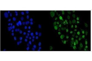 IF analysis of Periplakin using anti-Periplakin antibody (ABIN5518787). (PPL antibody  (C-Term))