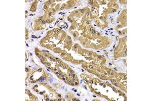 Immunohistochemistry of paraffin-embedded human kidney using WBSCR22 antibody (ABIN4905616) at dilution of 1:100 (40x lens). (WBSCR22 antibody)