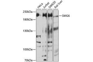 Western blot analysis of extracts of various cell lines, using SMG6 antibody (ABIN6133311, ABIN6148132, ABIN6148133 and ABIN6214288) at 1:1000 dilution. (SMG6 antibody  (AA 1160-1419))
