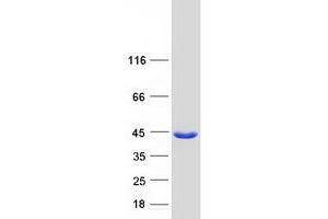 Western Blotting (WB) image for Small Glutamine-Rich Tetratricopeptide Repeat (TPR)-Containing, beta (SGTB) protein (Myc-DYKDDDDK Tag) (ABIN2731942)