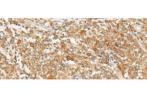 Immunohistochemistry of paraffin-embedded Human tonsil tissue using JPT1 Polyclonal Antibody at dilution of 1:35(x200) (JPT1 antibody)