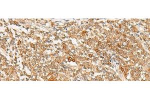 Immunohistochemistry of paraffin-embedded Human tonsil tissue using JPT1 Polyclonal Antibody at dilution of 1:35(x200)