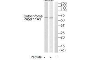 Western blot analysis of extracts from HeLa cells and A549 cells, using Cytochrome P450 11A1 antibody. (CYP11A1 antibody  (C-Term))