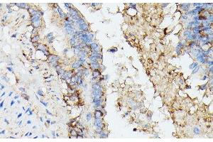 Immunohistochemistry of paraffin-embedded Rat lung using KRT14 Polyclonal Antibody at dilution of 1:100 (40x lens). (KRT14 antibody)