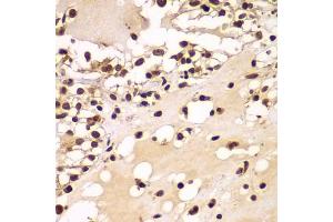 ZNF20 antibody  (AA 1-200)