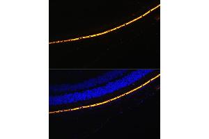 Immunofluorescence analysis of Mouse eye cells using RPE65 antibody (ABIN6130679, ABIN6147090, ABIN6147091 and ABIN6225161) at dilution of 1:100. (RPE65 antibody  (AA 274-533))