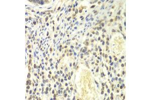 Immunohistochemistry of paraffin-embedded human colon using PSMA4 antibody (ABIN6291447) at dilution of 1:100 (40x lens). (PSMA4 antibody)