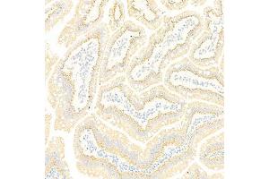 Immunohistochemistry analysis of paraffin-embedded rat small intestine using GBA (ABIN7074062) at dilution of 1: 2000