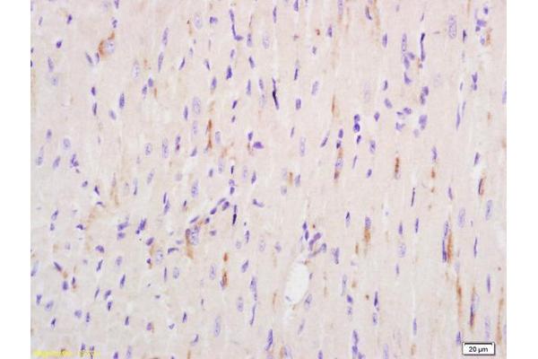 KCNJ8 antibody  (AA 61-160)