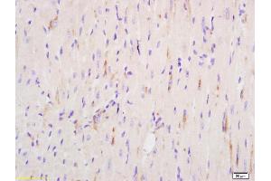 Formalin-fixed and paraffin embedded mouse heart tissue labeled with Anti-kir 6. (KCNJ8 antibody  (AA 61-160))