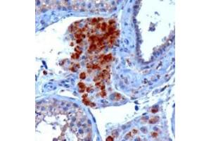 Image no. 1 for anti-SECIS Binding Protein 2 (SECISBP2) (Internal Region) antibody (ABIN374739) (SECISBP2 antibody  (Internal Region))