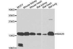 Western blot analysis of extracts of various cell lines, using NAA20 antibody. (NAT5 antibody)