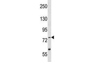 TLK2 antibody western blot analysis in Y79 lysate