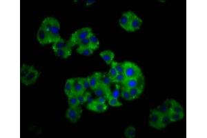 Immunofluorescence staining of HepG2 cells with ABIN7149218 at 1:166, counter-stained with DAPI. (CYP26C1 antibody  (AA 331-460))