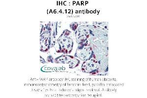 Image no. 1 for anti-Poly (ADP-Ribose) Polymerase 1 (PARP1) antibody (ABIN1723251) (PARP1 antibody)