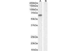 ABIN570957 (0. (SLC47A1 antibody  (Internal Region))