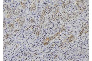 Immunohistochemistry (IHC) image for anti-Neuroblastoma 1, DAN Family BMP Antagonist (NBL1) (C-Term) antibody (ABIN6256865)