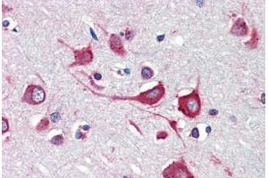 Human Brain, Cortex (formalin-fixed, paraffin-embedded) stained with Cholera Toxin antibody ABIN462099 at 10 ug/ml followed by biotinylated anti-mouse IgG secondary antibody ABIN481714, alkaline phosphatase-streptavidin and chromogen. (Calreticulin antibody)