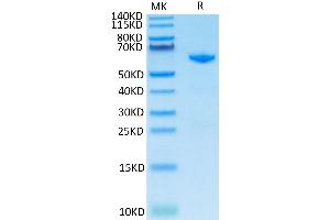 Cynomolgus CD73 on Tris-Bis PAGE under reduced condition. (CD73 Protein (AA 27-554) (His tag))