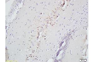 Formalin-fixed and paraffin embedded rat brain labeled with Anti-Slit2/Slil3 Polyclonal Antibody, Unconjugated (ABIN749963) at 1:300 followed by conjugation to the secondary antibody and DAB staining (SLIT2 antibody  (AA 451-550))