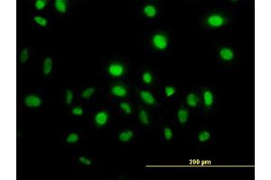 Immunofluorescence of monoclonal antibody to VAV1 on HeLa cell. (VAV1 antibody  (AA 681-790))