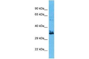 Western Blotting (WB) image for anti-Olfactory Receptor, Family 2, Subfamily W, Member 1-Like (OR2W3) (C-Term) antibody (ABIN2791730) (OR2W3 antibody  (C-Term))
