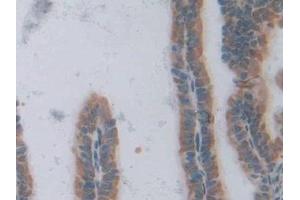 Immunohistochemistry (IHC) image for anti-Transcription Factor 20 (TCF20) (AA 1871-1965) antibody (ABIN7438469)