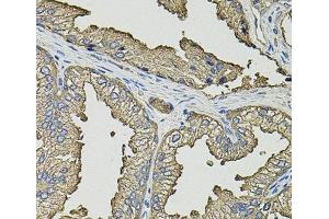 Immunohistochemistry of paraffin-embedded Human prostate using SMN2 Polyclonal Antibody