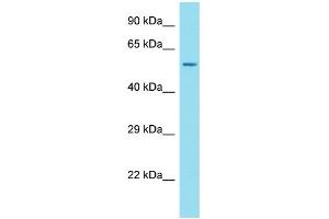 Host: Rabbit Target Name: ANKRD34C Sample Type: OVCAR-3 Whole Cell lysates Antibody Dilution: 1. (ANKRD34C antibody  (N-Term))