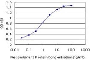 Detection limit for recombinant GST tagged CA1 is approximately 0. (CA1 antibody  (AA 1-261))
