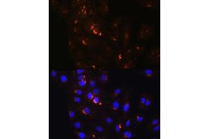 Immunofluorescence analysis of H9C2 cells using POFUT2 Rabbit pAb (ABIN6130656, ABIN6145875, ABIN6145876 and ABIN6215831) at dilution of 1:100.